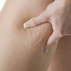 Reafirmante con envolturas para celulitis joven